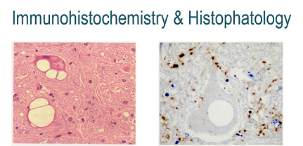 Inmunohistoquímica e histopatología