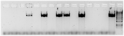 PCR convencional previa a la digestión